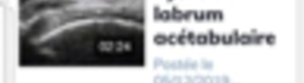 ECHO-LOCO pour smartphone