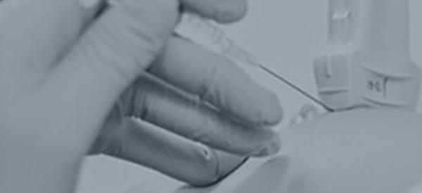 Infiltrations écho guidées en pratique : 3 par échographes (DPC n°82142200012)