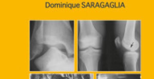 Traumatologie à l'usage de l'urgentiste: 3eme édition