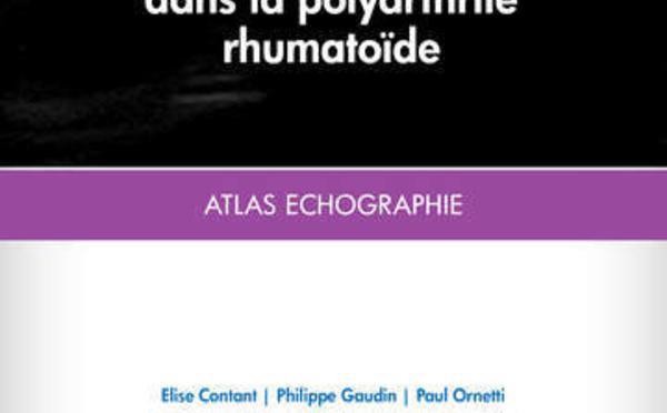 SCORES ECHO (Scores Echographiques de la PR)