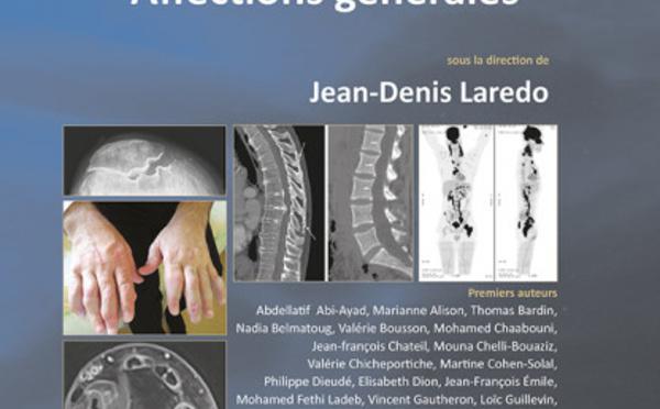 Imagerie Rhumatologique - Affections Générales