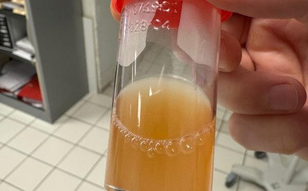 Effraction de la capsule articulaire fémoro-tibiale