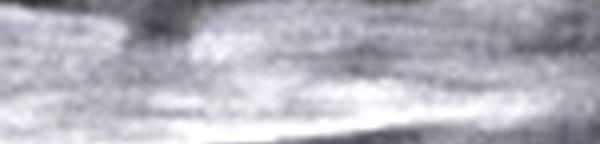 Une écharde de bois dans la paroi abdominale