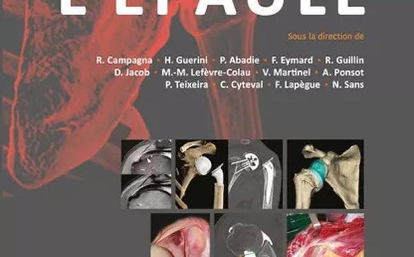 L'EPAULE