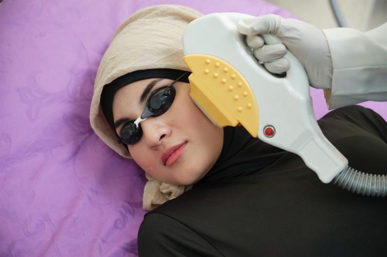 Acne Laser