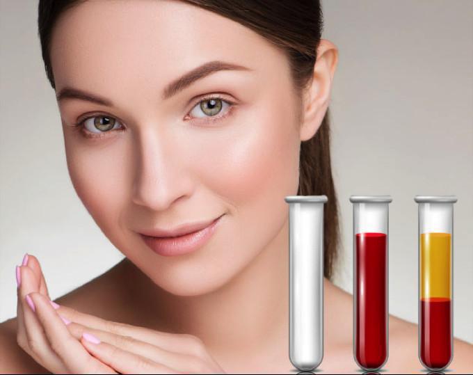 PRP (Vampire Facial, Hair Loss, Stretch Mark)