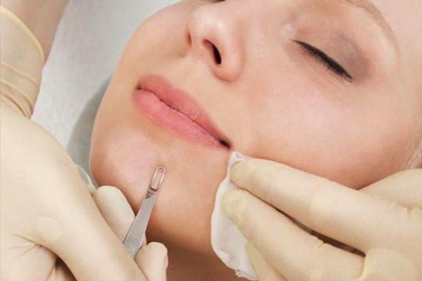 Acne Clarifying Treatment