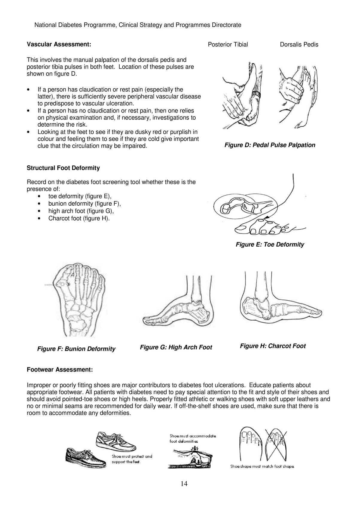 Model of care for the diabetic foot 