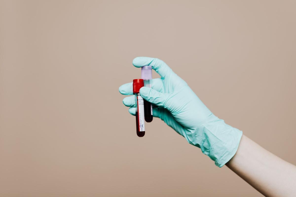 Prenotazioni esami sangue e visite in ASL