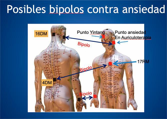 TERAPIA BIPOLAR