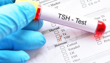 Misurazione del TSH Misurazione del TSH