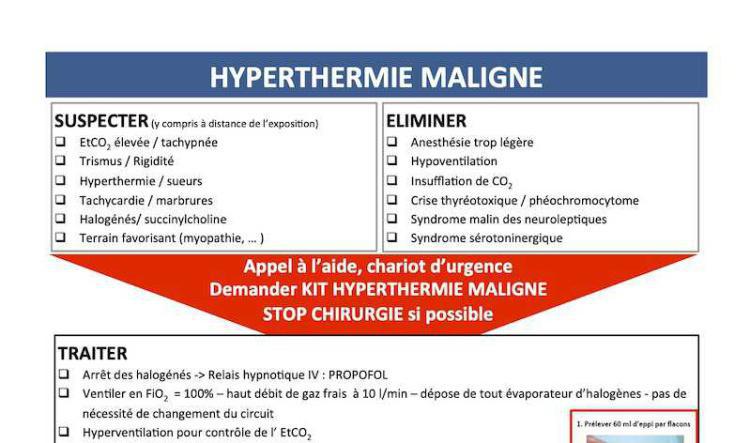 Hyperthermie maligne