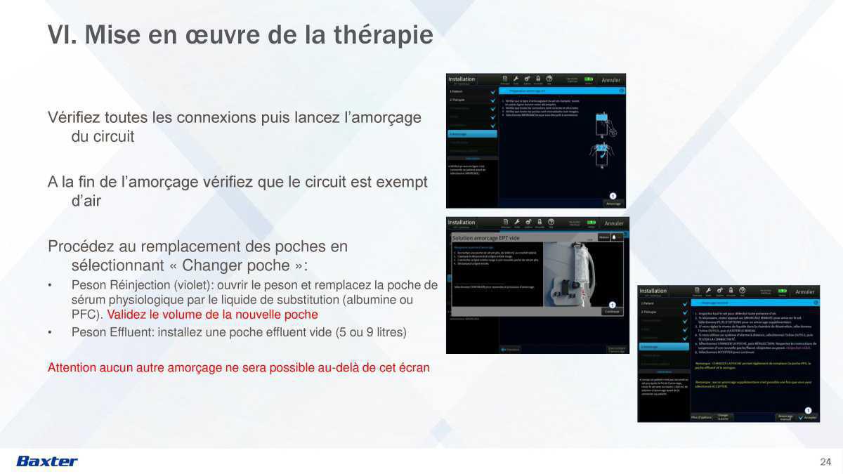Prismax : Echanges Plasmatiques