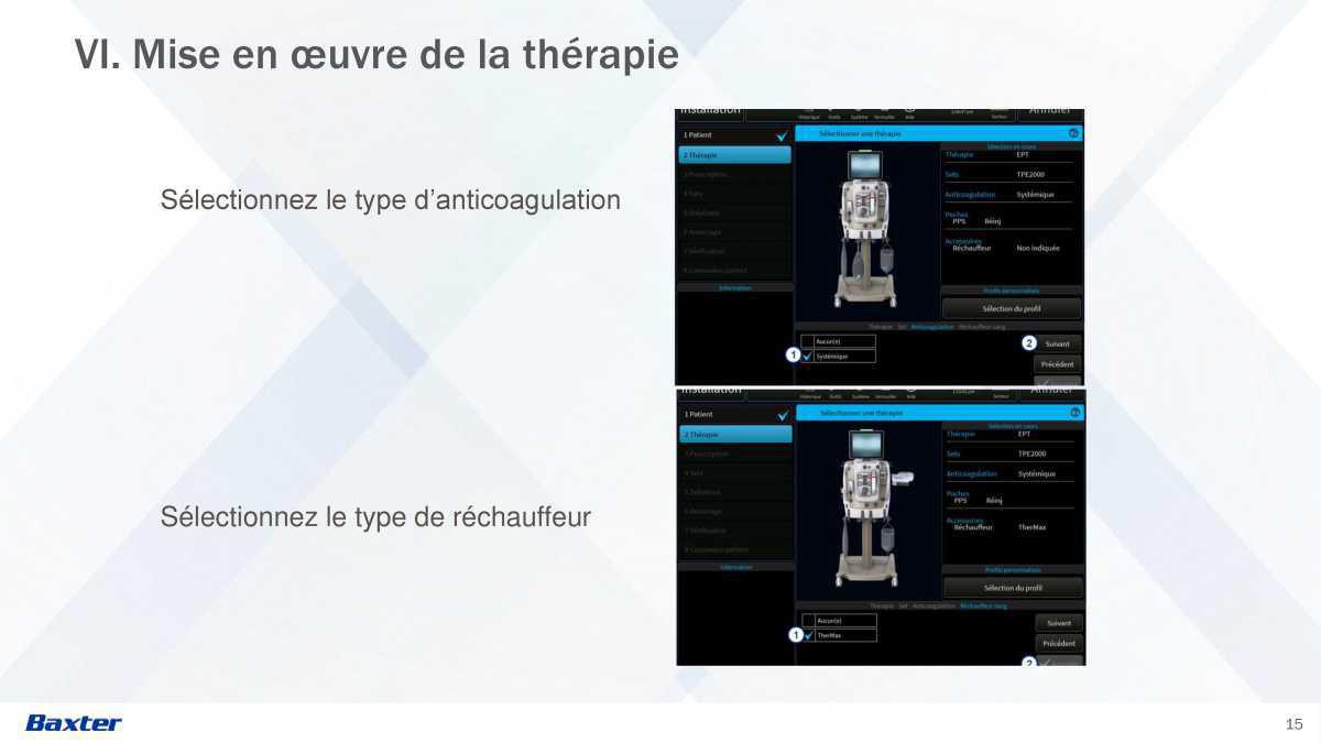 Prismax : Echanges Plasmatiques