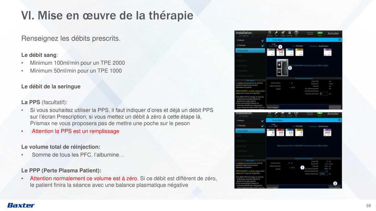 Prismax : Echanges Plasmatiques