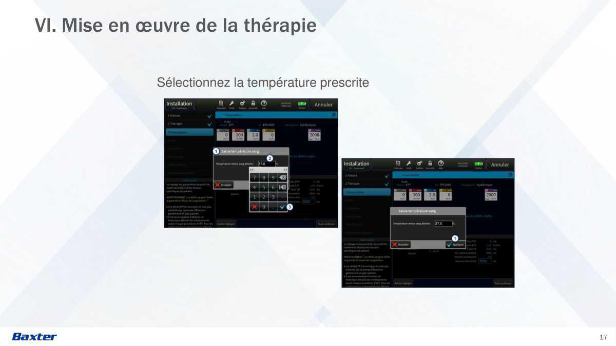 Prismax : Echanges Plasmatiques