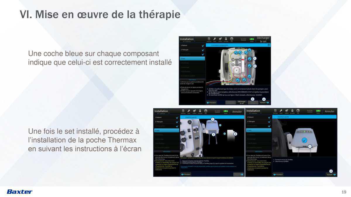 Prismax : Echanges Plasmatiques