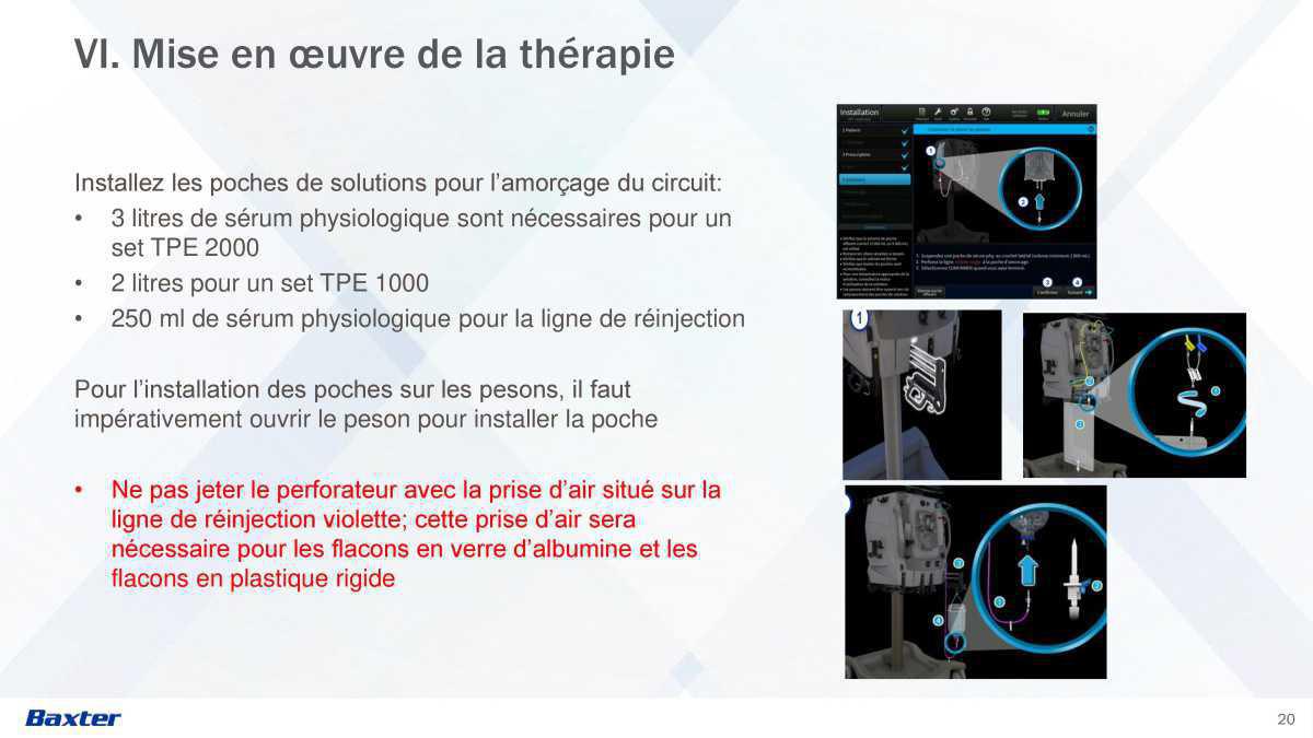 Prismax : Echanges Plasmatiques