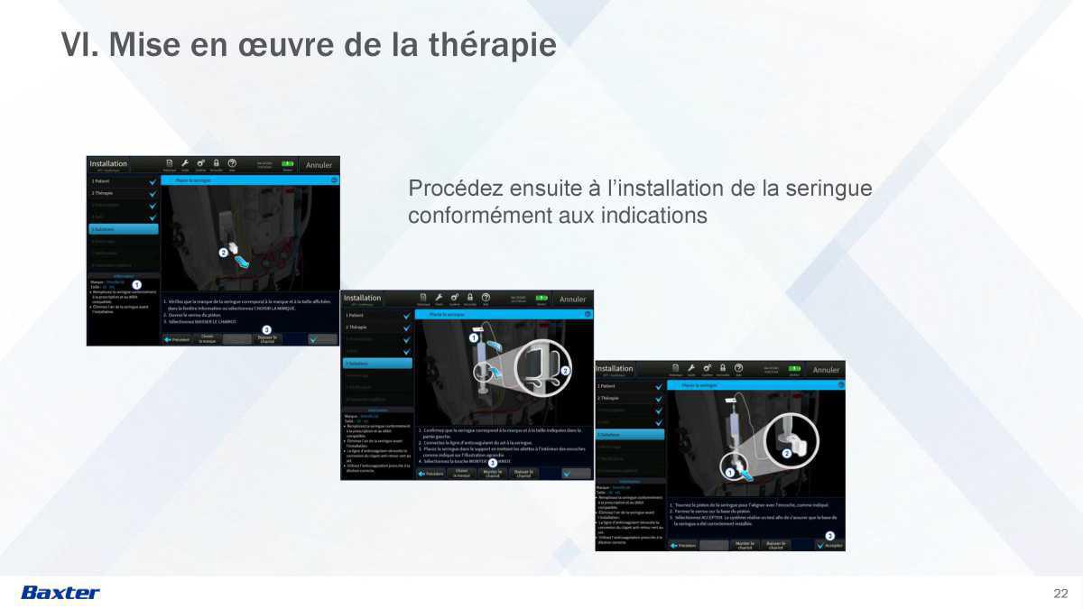 Prismax : Echanges Plasmatiques