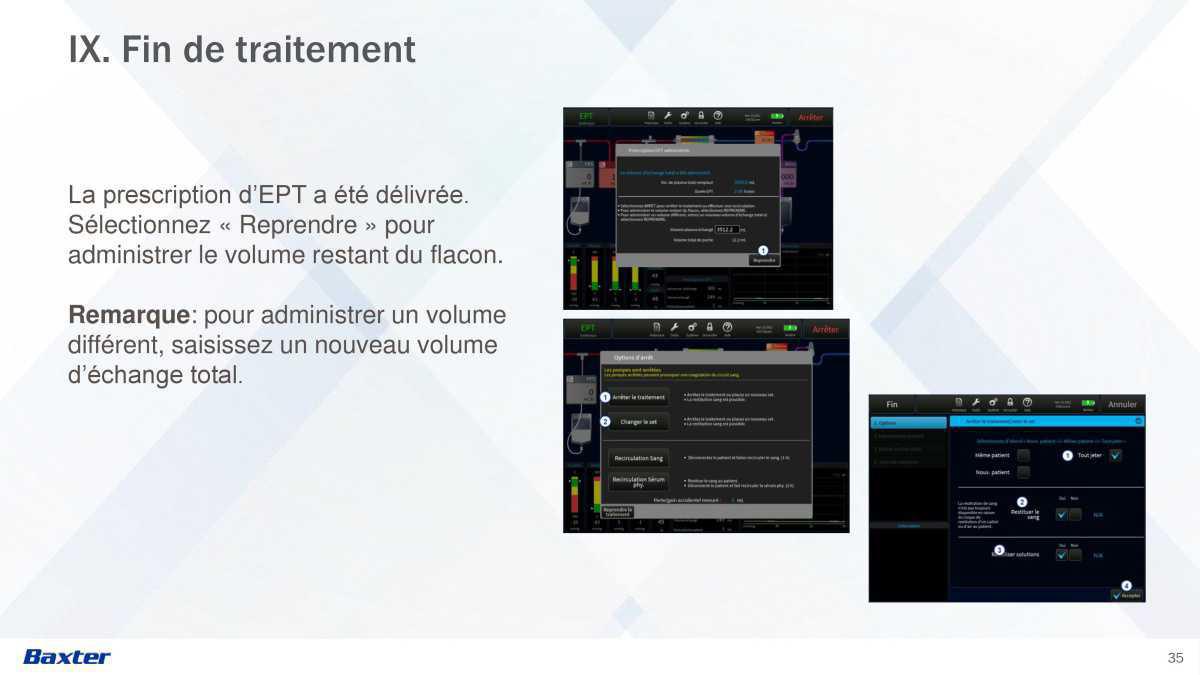 Prismax : Echanges Plasmatiques