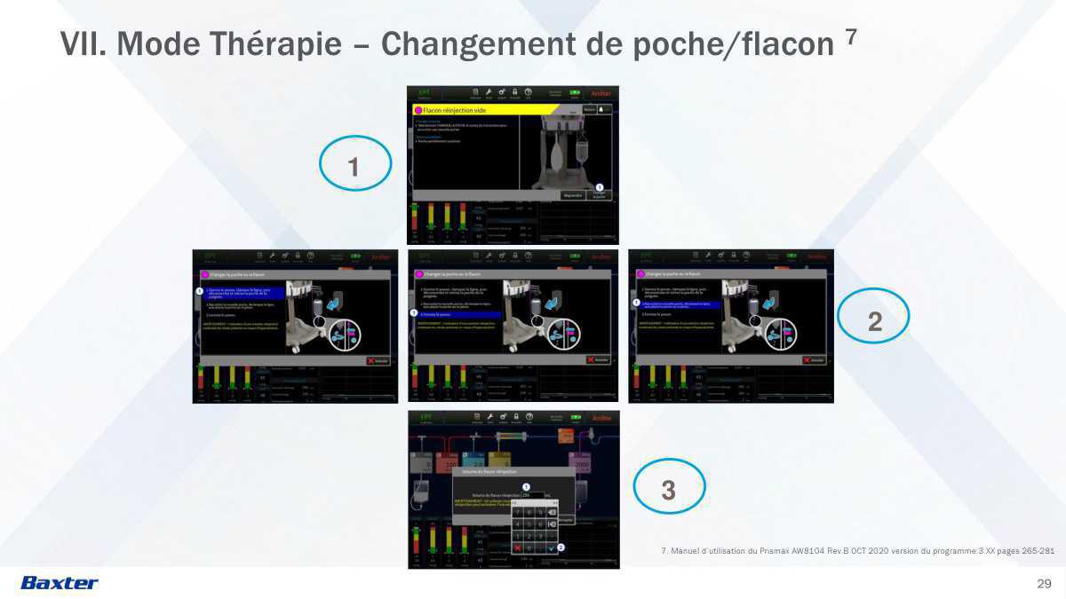 Prismax : Echanges Plasmatiques