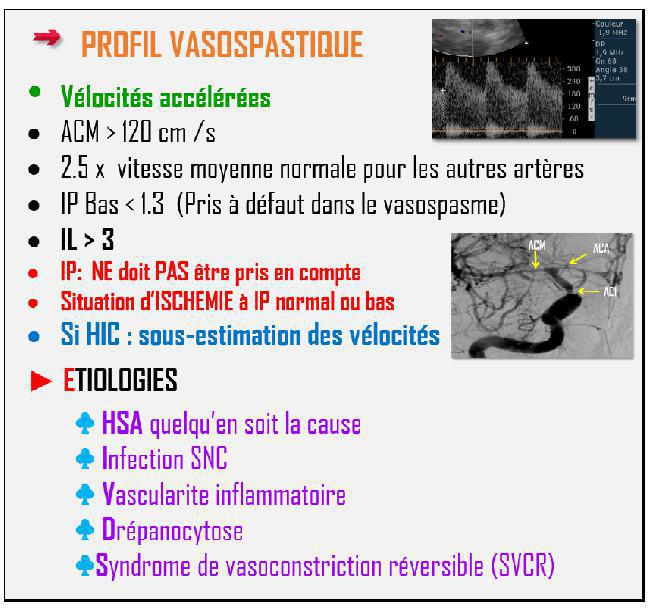 DTC (Doppler Transcranien)