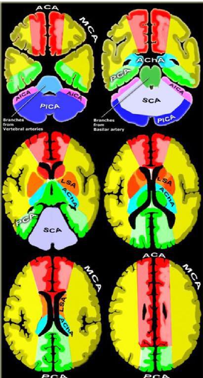 DTC (Doppler Transcranien)