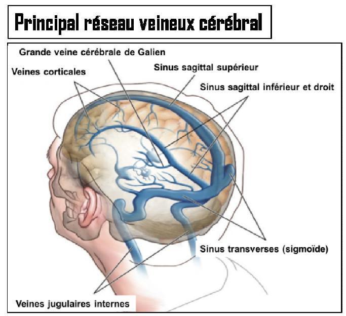DTC (Doppler Transcranien)