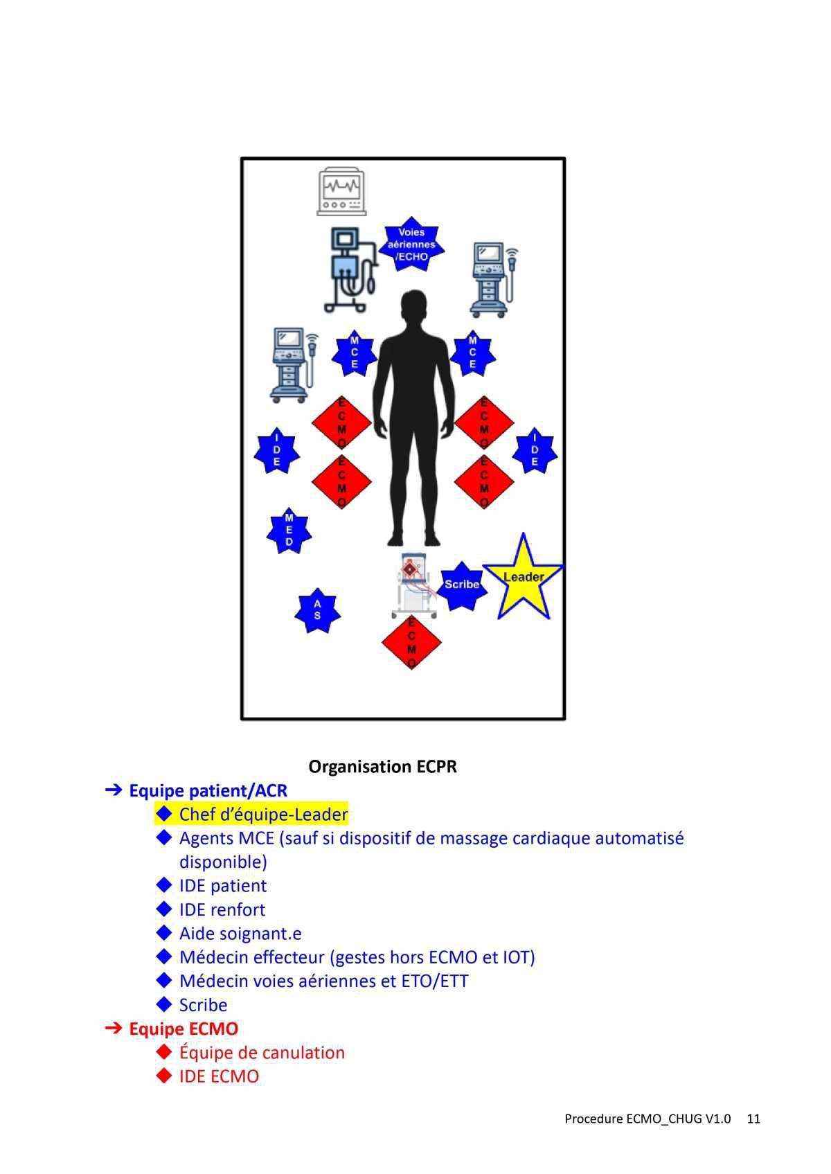 Procédure ECMO au CHUG