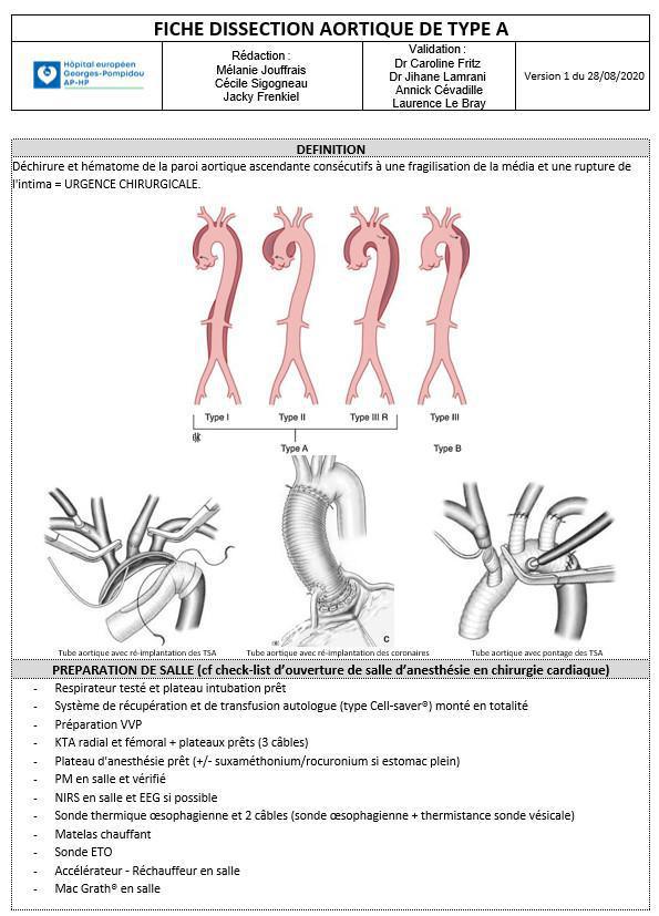 Dissection aortique de type A