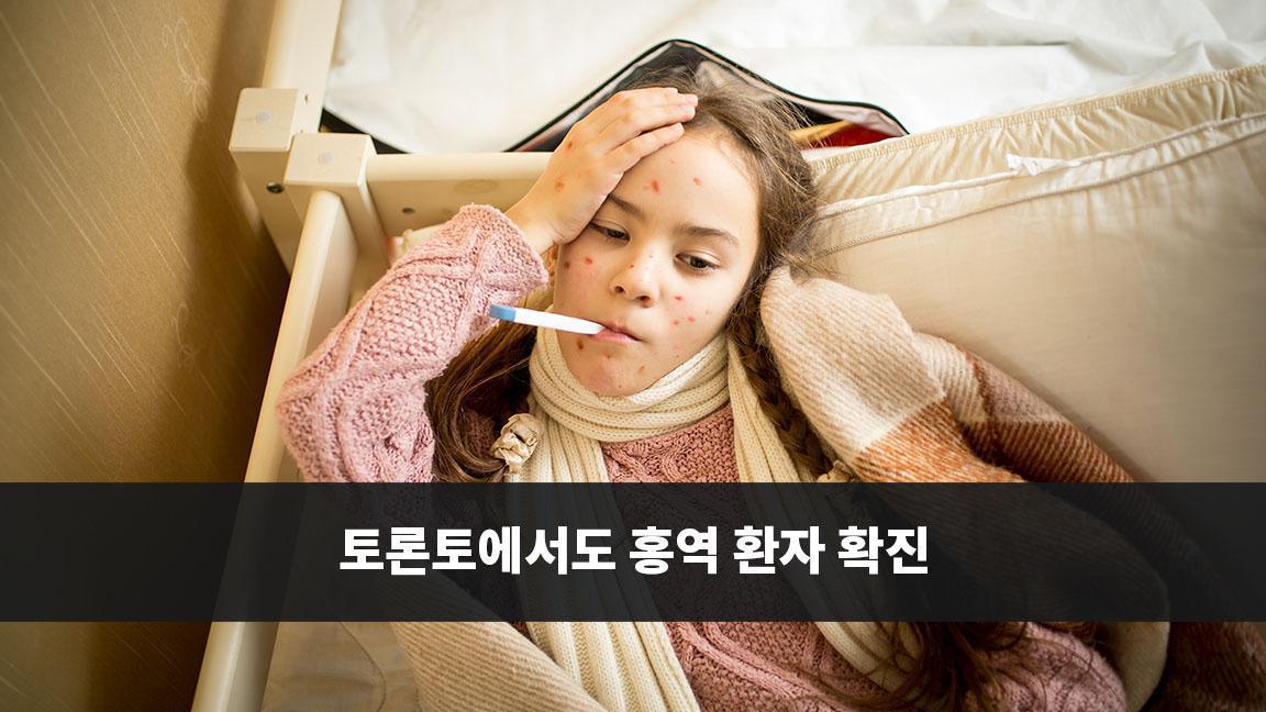 토론토에서도 홍역 환자 확진 토론토에서도 홍역 환자 확진