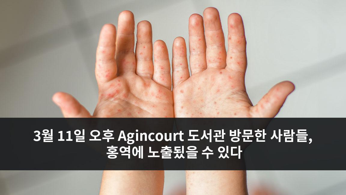 3월 11일 오후 Agincourt 도서관 방문한 사람들, 홍역에 노출됬을 수 있다 3월 11일 오후 Agincourt 도서관 방문한 사람들, 홍역에 노출됬을 수 있다