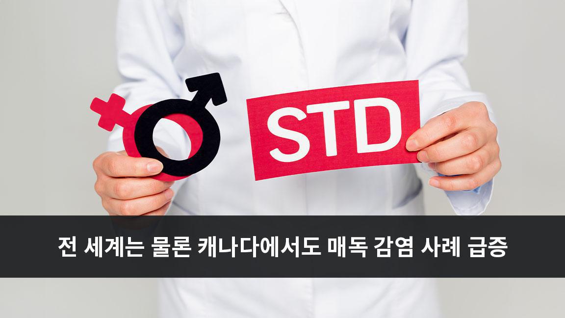 전 세계는 물론 캐나다에서도 매독 감염 사례 급증 전 세계는 물론 캐나다에서도 매독 감염 사례 급증