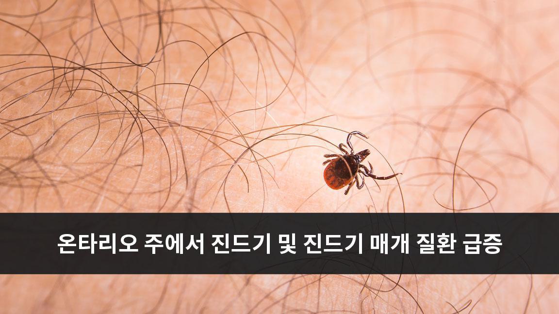 온타리오 주에서 진드기 및 진드기 매개 질환 급증 온타리오 주에서 진드기 및 진드기 매개 질환 급증