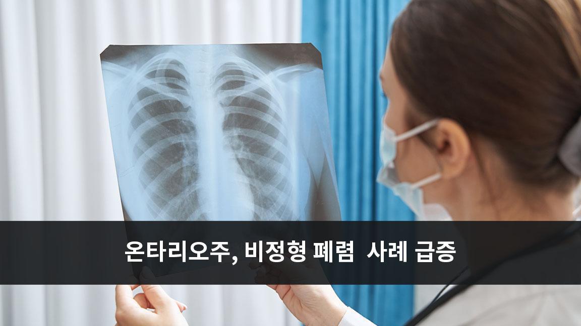 온타리오주, 비정형 폐렴 (Walking Pneumonia) 사례 급증: 2019년 대비 3배 증가 온타리오주, 비정형 폐렴 (Walking Pneumonia) 사례 급증: 2019년 대비 3배 증가