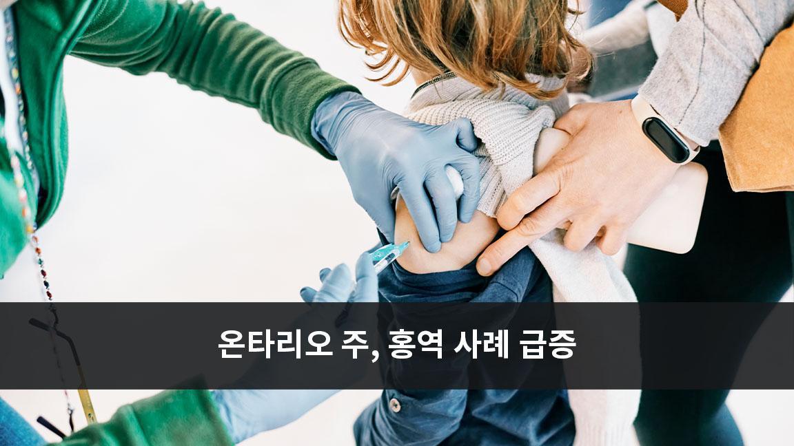 온타리오 주, 홍역 사례 급증 온타리오 주, 홍역 사례 급증