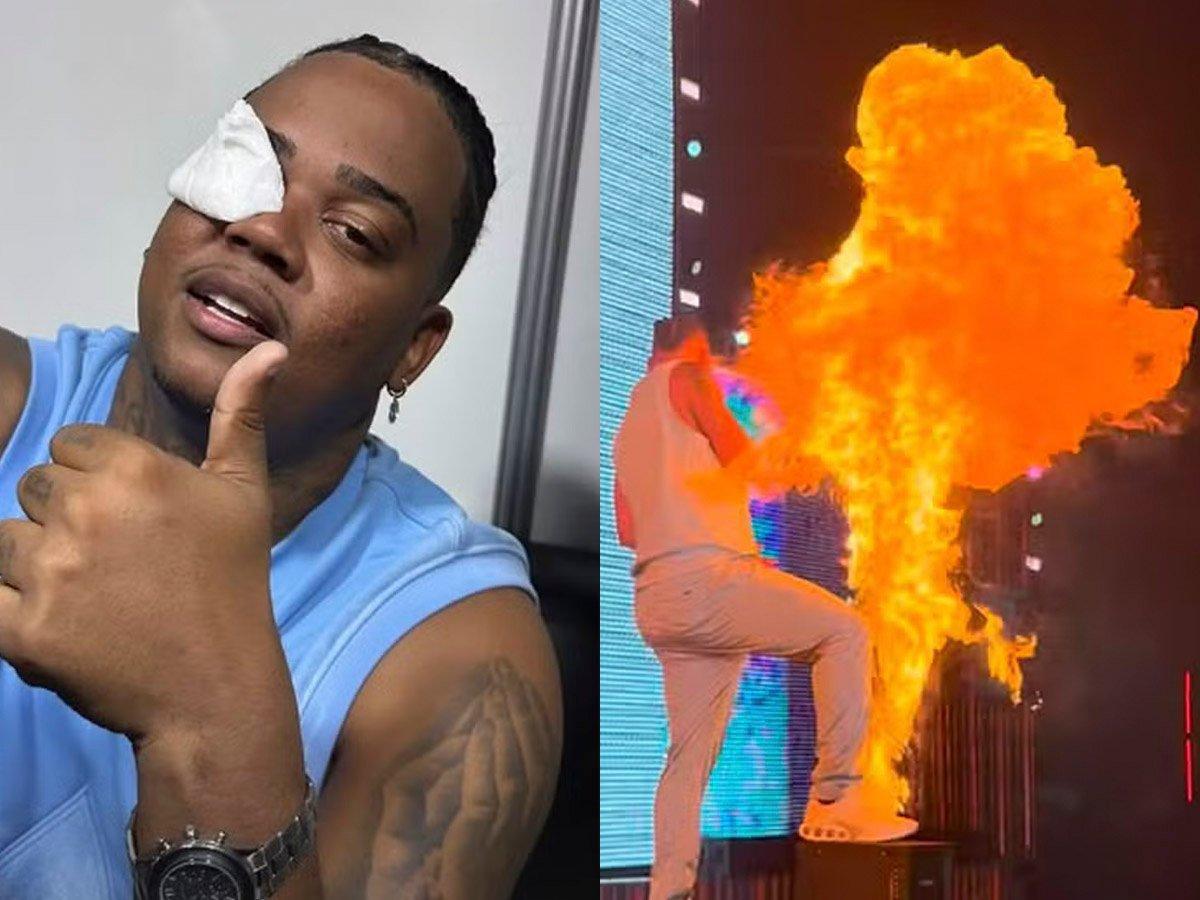 Rapper Major RD leva susto com máquina de fogo e se queima em show Rapper Major RD leva susto com máquina de fogo e se queima em show