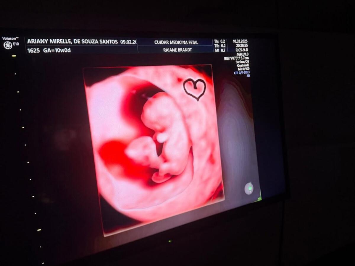 Esperando o segundo filho, João Gomes e Ary Mirelle compartilham imagens do ultrassom