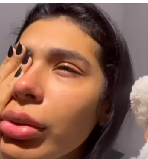 Pocah sofre lesão ocular em acidente e cancela show previsto no Rio Pocah sofre lesão ocular em acidente e cancela show previsto no Rio