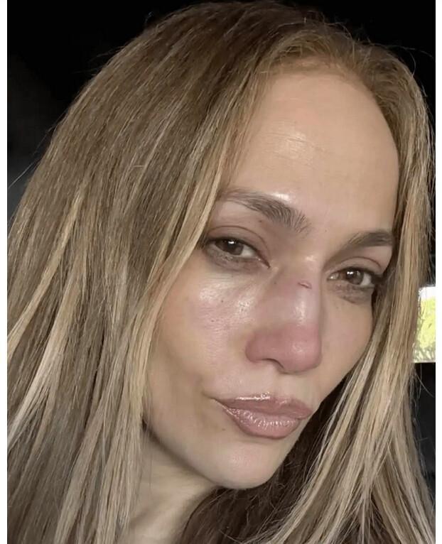 Acidente em ensaio compromete performance de Jennifer Lopez no AMA 2025