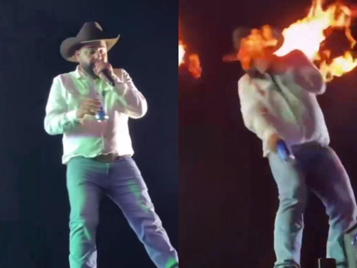 Acidente em show: Léo, da dupla com Raphael, sofre queimaduras faciais Acidente em show: Léo, da dupla com Raphael, sofre queimaduras faciais