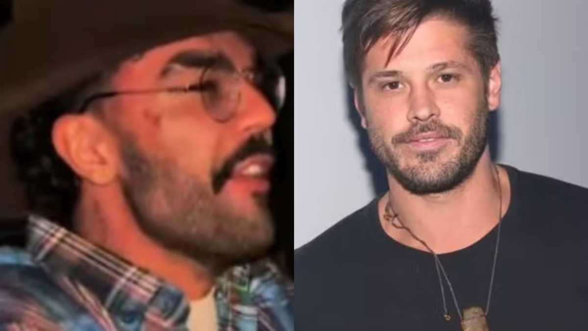 Luan Pereira surge com o rosto machucado após confusão com Dado Dolabella
