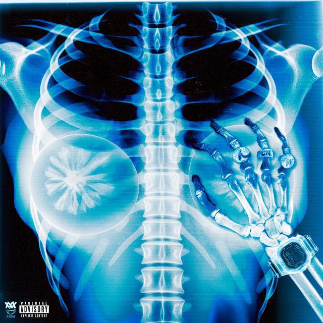 Peito Falso - Arthurzim & Mc Rodrigo do CN & WIU & OLIE - Música e Letra