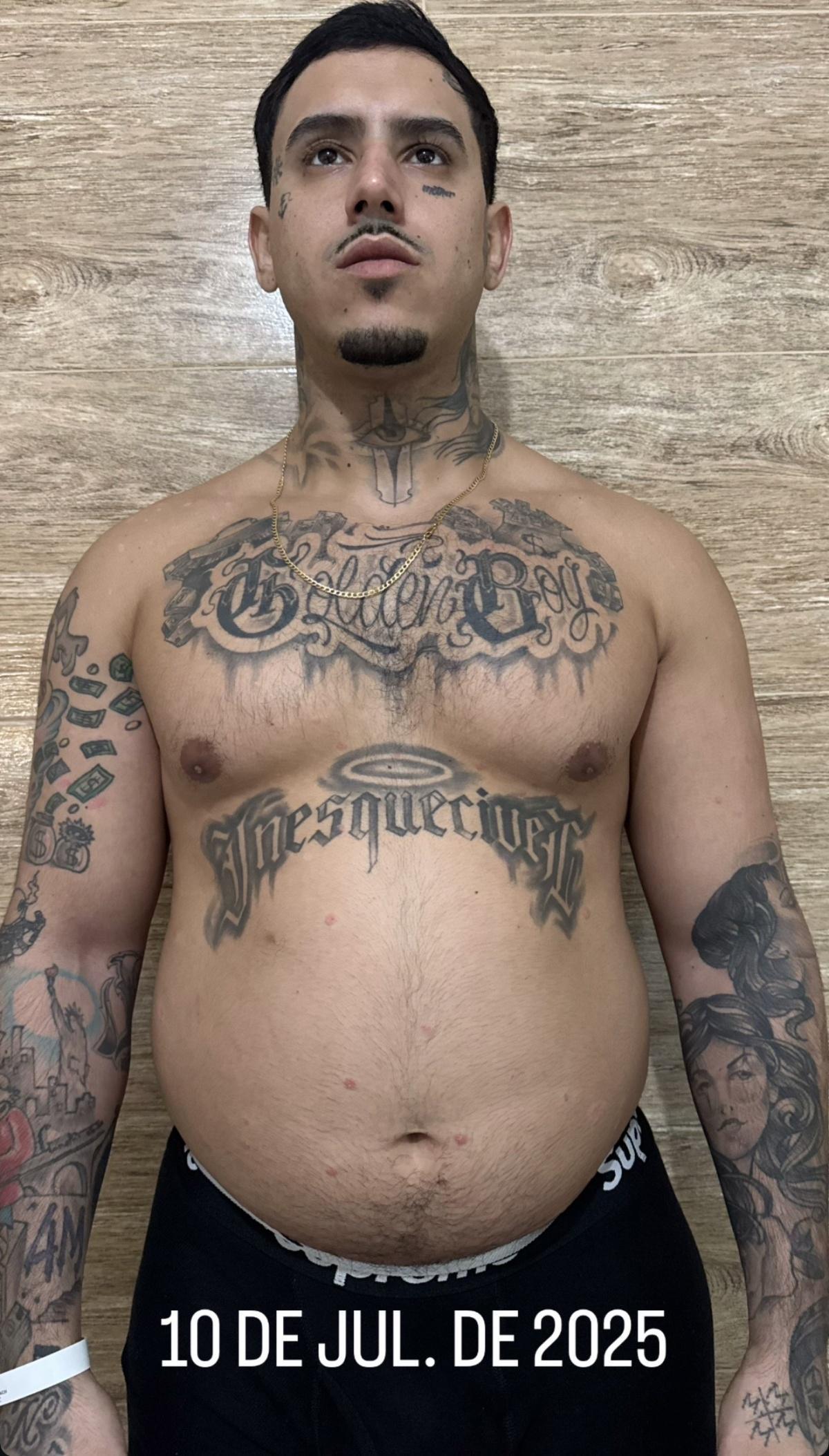 MC PH exibe antes e depois e abre o jogo sobre transformação: "Não foi estética, foi necessidade"
