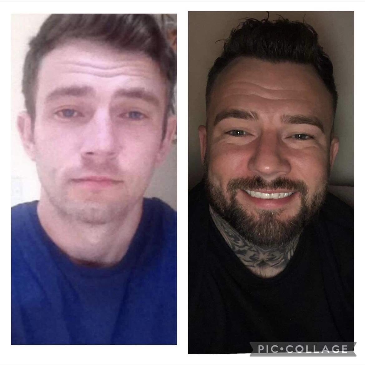 Sam’s Tips to Get From Drug Addiction to Recovery ❤️🙌 Sam’s Tips to Get From Drug Addiction to Recovery ❤️🙌