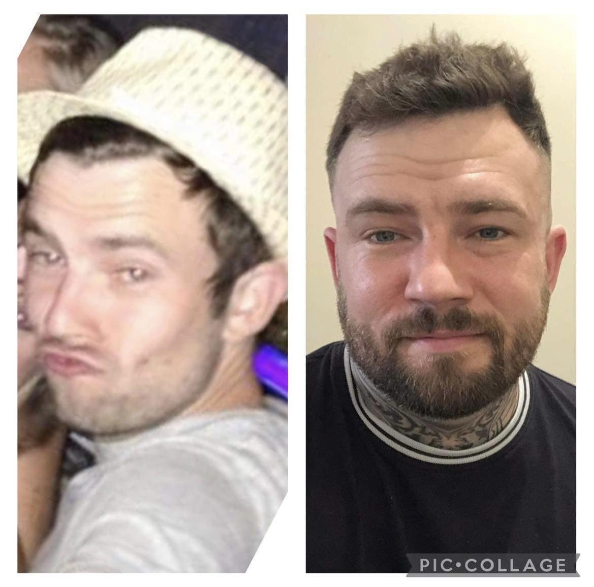 Sam’s Tips to Get From Drug Addiction to Recovery ❤️🙌 Sam’s Tips to Get From Drug Addiction to Recovery ❤️🙌