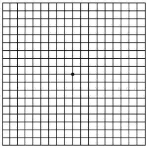 Test de la rejilla de Amsler Test de la rejilla de Amsler