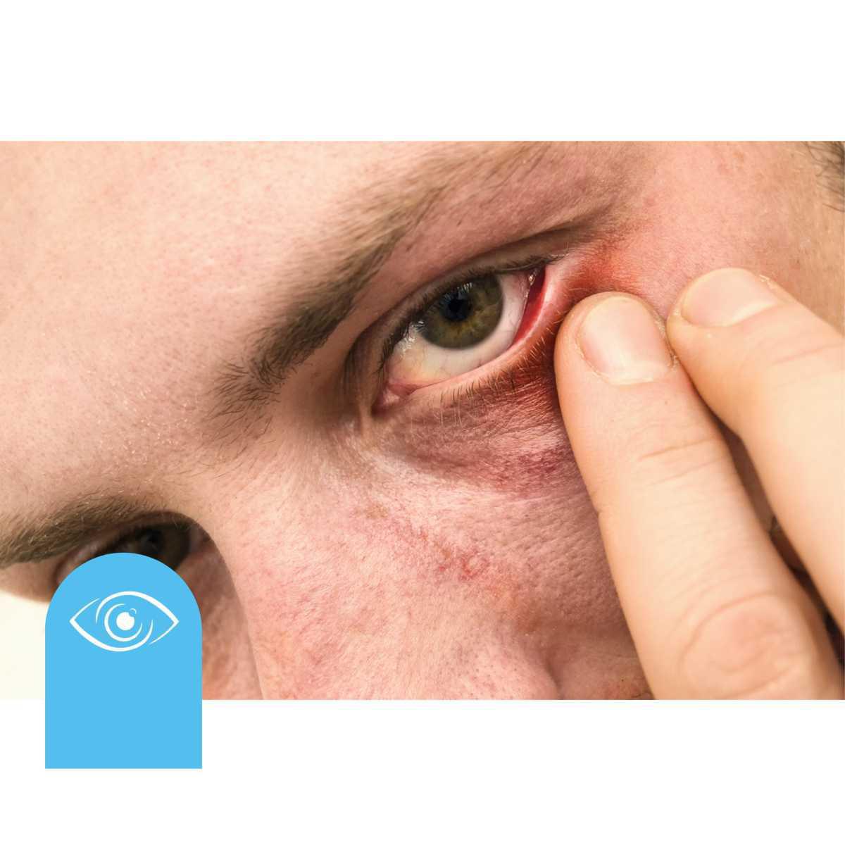 Complicaciones Complicaciones