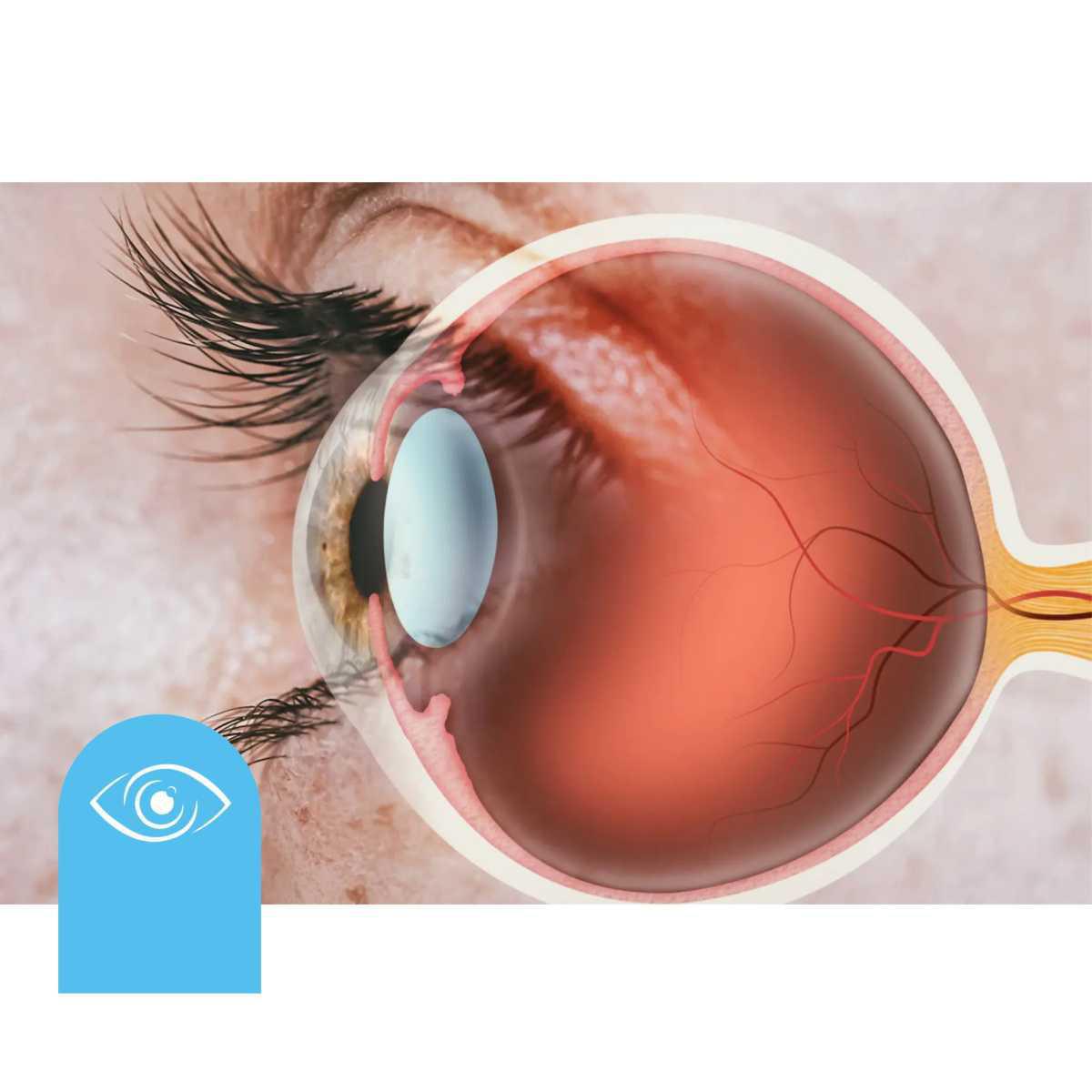 La película lagrimal