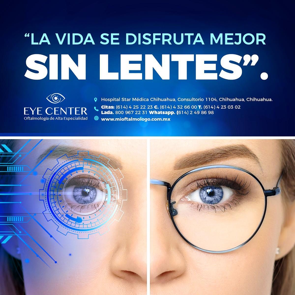 Sin lentes es mejor